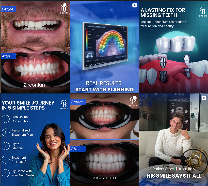 Begler Dental - Meta Ads Kreatif